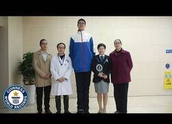 Enlace a El adolescente más alto del mundo