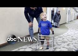 Enlace a Un medallista paralímpico anima a un niño a dar sus primeros pasos con protesis