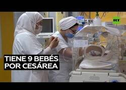 Enlace a Una mujer bate un record al dar a luz a 9 bebés