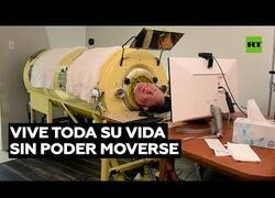 Enlace a El hombre que lleva 70 años sin poder moverse