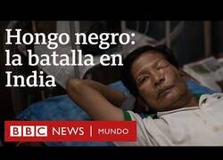 Enlace a Hongo Negro: La epidemia dentro de la pandemia que sufren en India