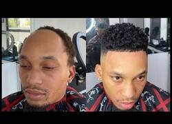 Enlace a Cómo dejar de ser calvo sin pasar por Turquía