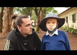 Enlace a Terrible lo que sucede con los albinos en Africa