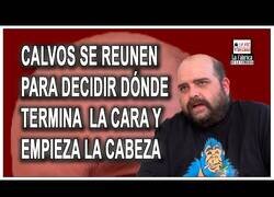 Enlace a Por fin la gran duda sobre los calvos se va a resolver