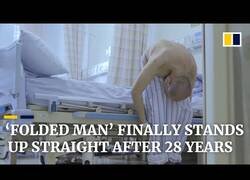 Enlace a El hombre que pasó 28 años en una mala postura