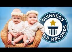 Enlace a Los gemelos más prematuros del mundo