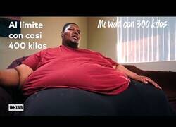 Enlace a Así es vivir con 400 kilos