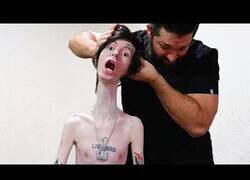 Enlace a El cuello más largo del mundo pasa por el fisio