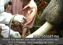 Enlace a Reparando el colmillo de un elefante