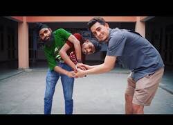 Enlace a Estos hermanos comparten un mismo cuerpo