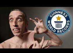 Enlace a El hombre con la piel más elástica del mundo