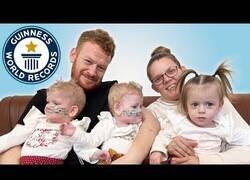 Enlace a Los trillizos más prematuros del mundo