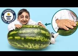 Enlace a El hombre con las manos más pequeñas del mundo