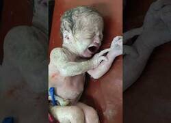 Enlace a Así es un bebé nada más nacer