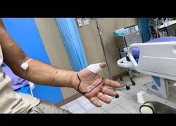 Enlace a Así está Frank Cuesta tras sufrir la peor mordedura de víbora posible