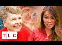 Enlace a Señora acude a que le extraigan un punto negro que la acompaña desde hace 55 años