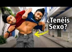 Enlace a Así es vivir compartiendo cuerpo con tu hermano gemelo