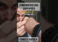 Enlace a Esto es lo que debes hacer si te muerde una garrapata