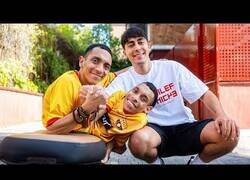Enlace a Nil Ojeda pasa un día con unos hermanos siameses