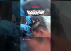Enlace a Detienen a un narco en Colombia que ocultaba droga bajo una peluca