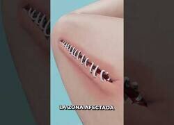 Enlace a ¿Cómo se hacen las suturas?