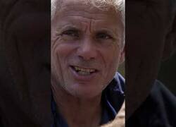 Enlace a Una morena le arranca un pulgar y el cirujano lo sustituye por un dedo de su pie