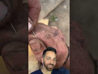 Cuando te clavas una pequeña astilla