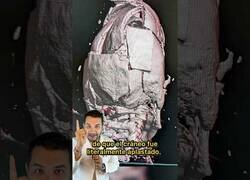 Enlace a Así se ve un cráneo aplastado