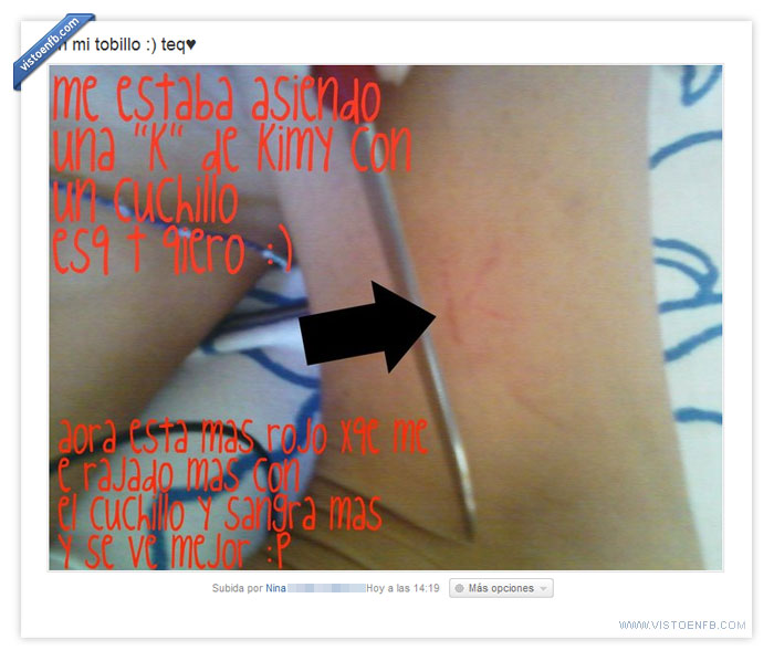 tobillo,k,foto,estúpido,escarificación,fail,bobo