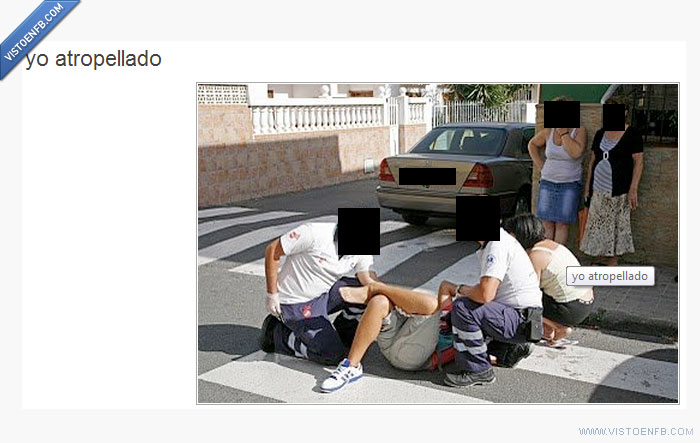 pierna,foto,coche,atropello