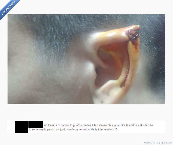 oreja,operación,frikismo,elfo