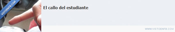 estudiante,callo