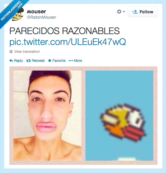 flappy bird,labio,chico,botox,silicona