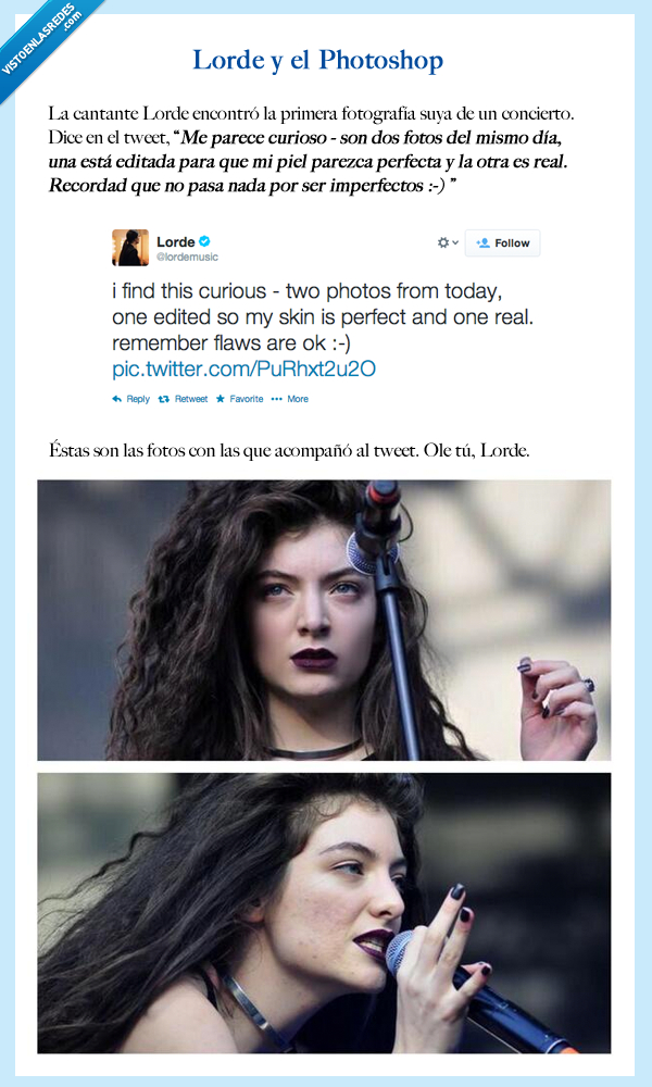 lorde,granos,piel,perfecta,imperfecto,flaw,cantante,cantar,royals,photoshop,cara