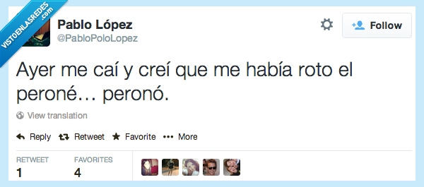 roto,romper,partir,perono,peroné,cai