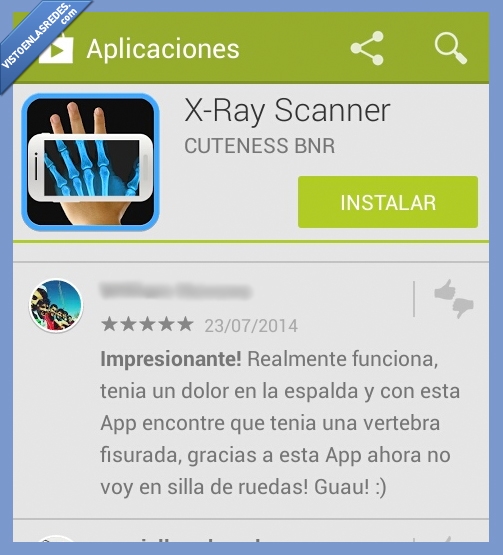 milagro,xray,rayos x,dolor,espalda,vertebra,silla de ruedas,curar