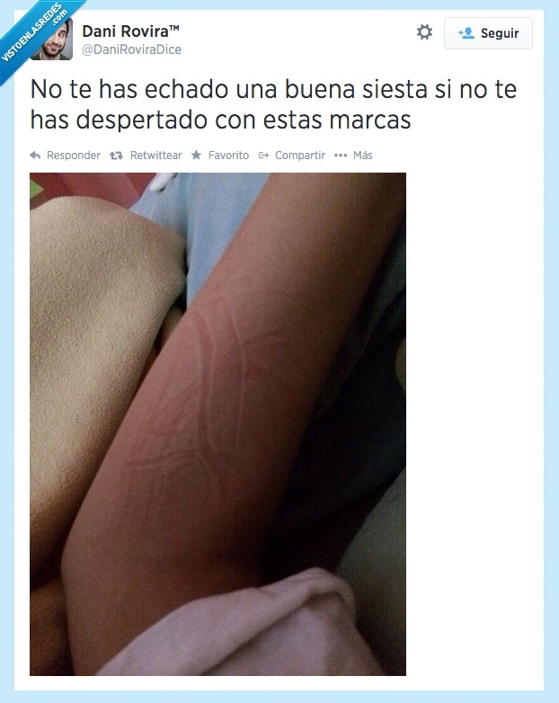 piel,cuerpo,sabana,sofa,dormir,marca,siesta