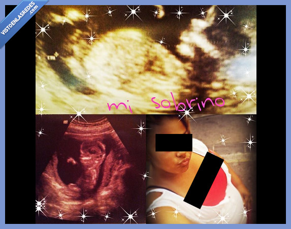 ecografia,niño,bebe,sobrino,chica,enseñar,innecesario,montaje,cutre,choni