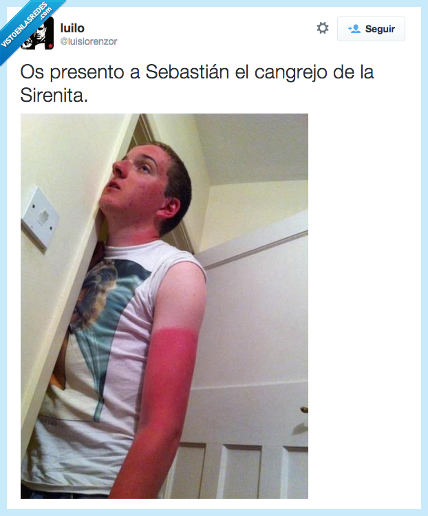 quemado,quemar,sol,insolacion,rojo,cangrejo,sirenita,sebastian,dolor