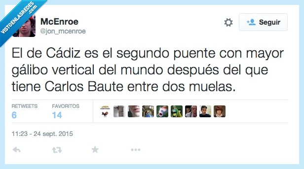 Carlos Baute,boca,puente,Cadiz,empaste,galibo,muelas