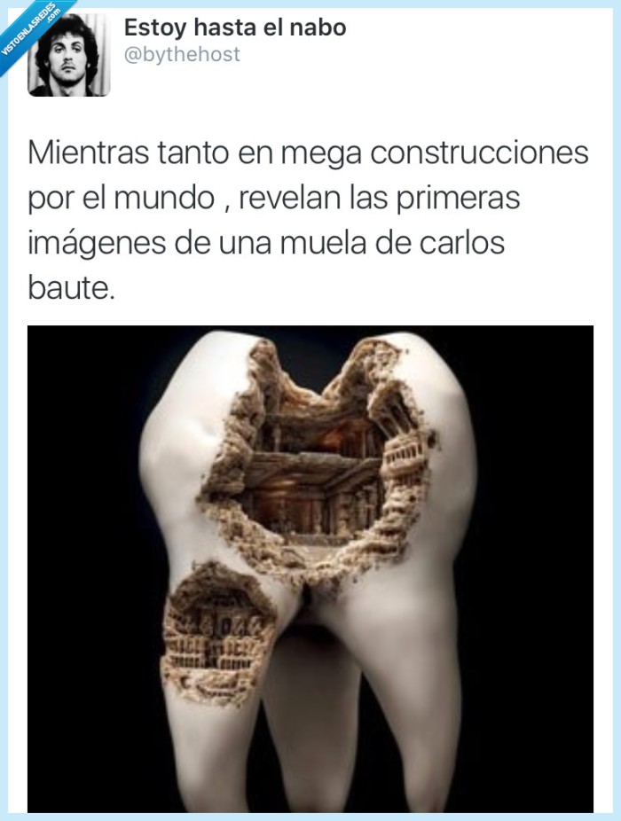 muela,gigante,megaconstrucciones,Carlos Baute