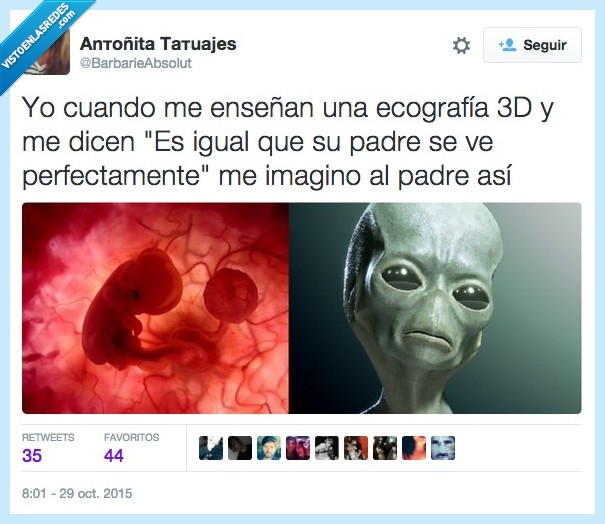 engañan,engañar,ecografia,parecido,alien,clavado,feto