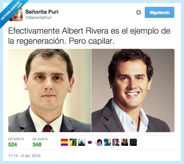 Albert Rivera,Ciudadanos,política,España,pelo,regeneración,injerto,capilar,crecer