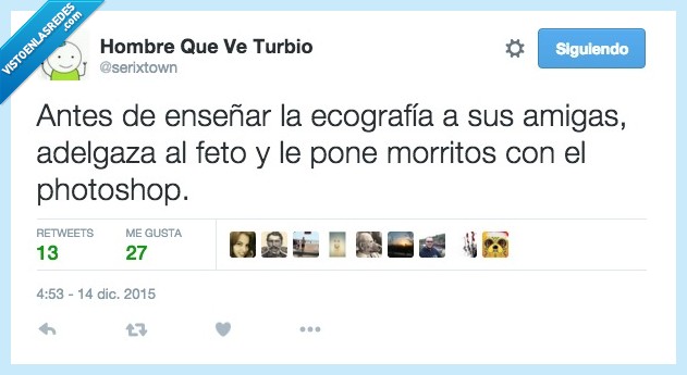 antes,enseñar,ecografia,foto,amigas,filtro,adelgaza,bebe,hijo,feto,nacer,morritos,photoshop