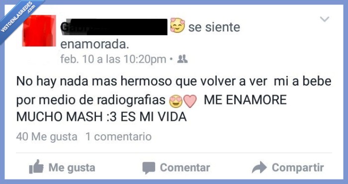 ecografía,mainstream,bebé radioactivo,radiografía,hijo