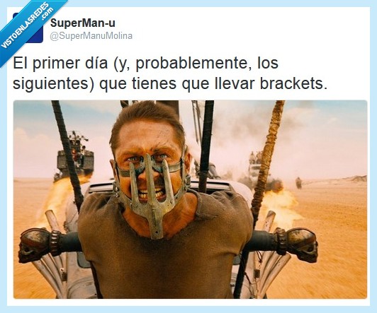 brackets,mad max,fury road,aparatos,dientes