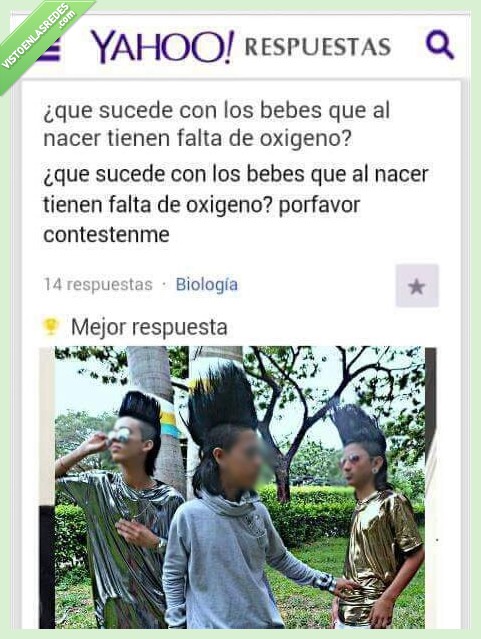 falta,oxigeno,bebe,cerebro,nacer,pelo,cani