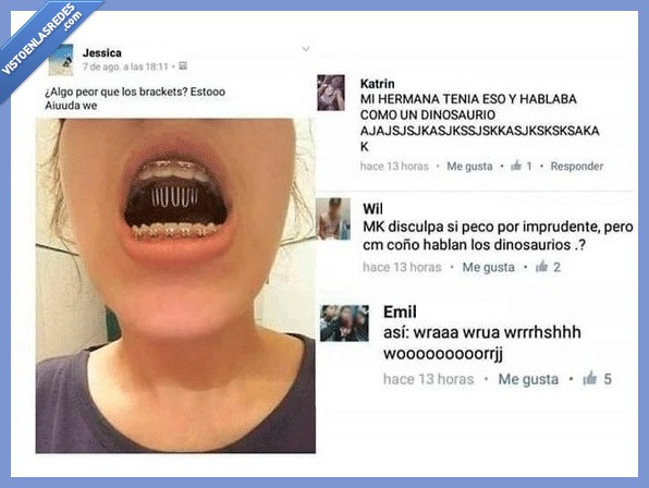 hablar,dinosaurio,hermana,ortodoncia,brackets