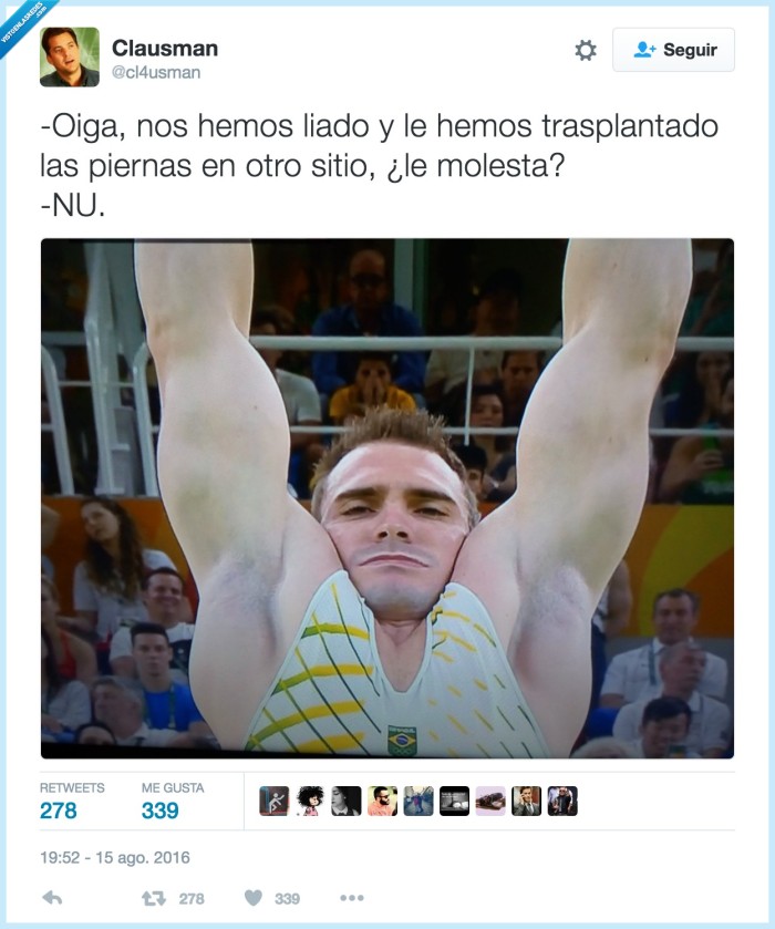 transplante,brazos,piernas,gimnasta