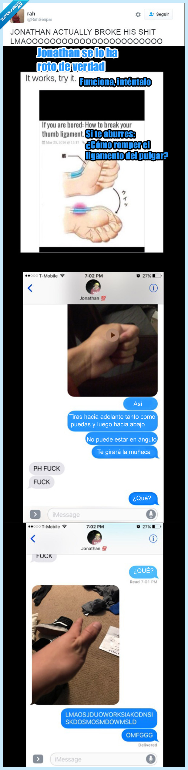 ligamento,pulgar,estupidez